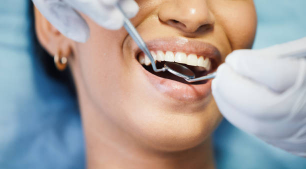 Best Emergency Dental Care for Broken or Chipped Teeth in Heidelberg, PA